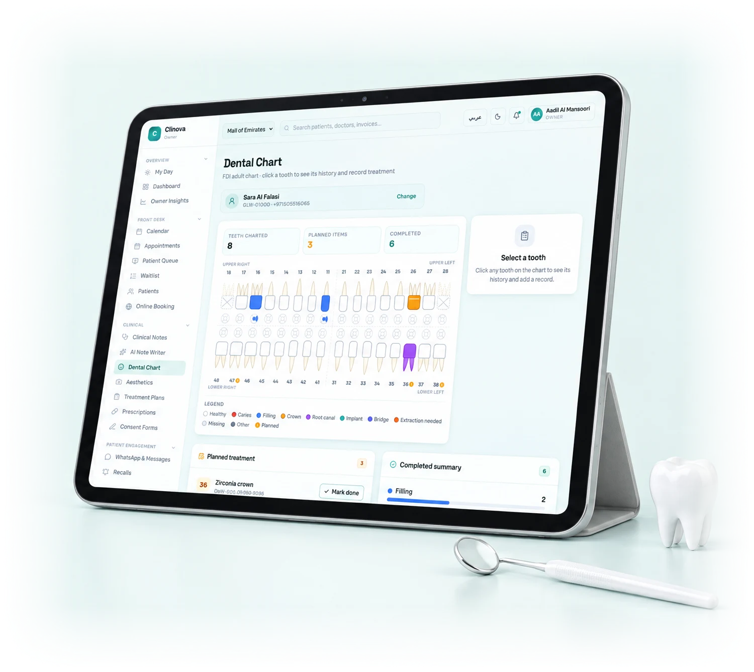 A tooth chart dentists enjoy using.